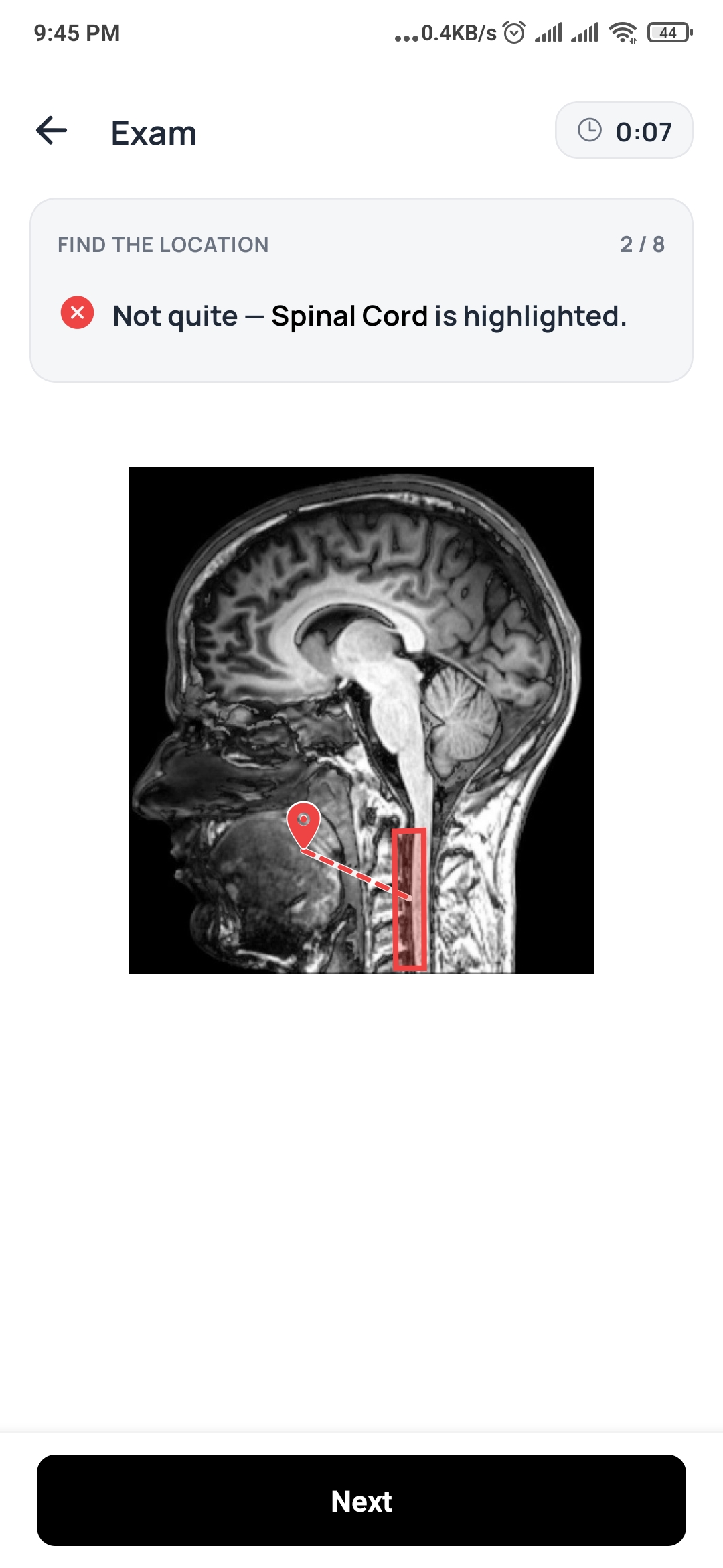 DeepRevision image labelling exam on a sagittal MRI of the head: the student tapped the wrong place and the spinal cord is highlighted